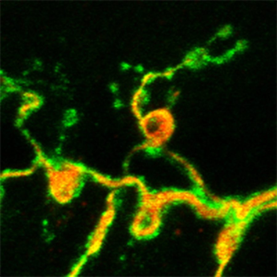 	Courtesy of Alyssa Coyne 

	Image of a Drosophila neuromuscular junction synapse. Amyotrophic lateral aclerosis patients show abnormal neuromuscular transmission. 