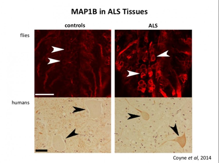 Courtesy of Daniela ZarnescuNormal and abnormal expression of MAP1B in human ALS patients and fly model of ALS. The fly model and human patient show nearly identical abnormalities in expression of this messenger RNA, which is involved in microtubule stability.