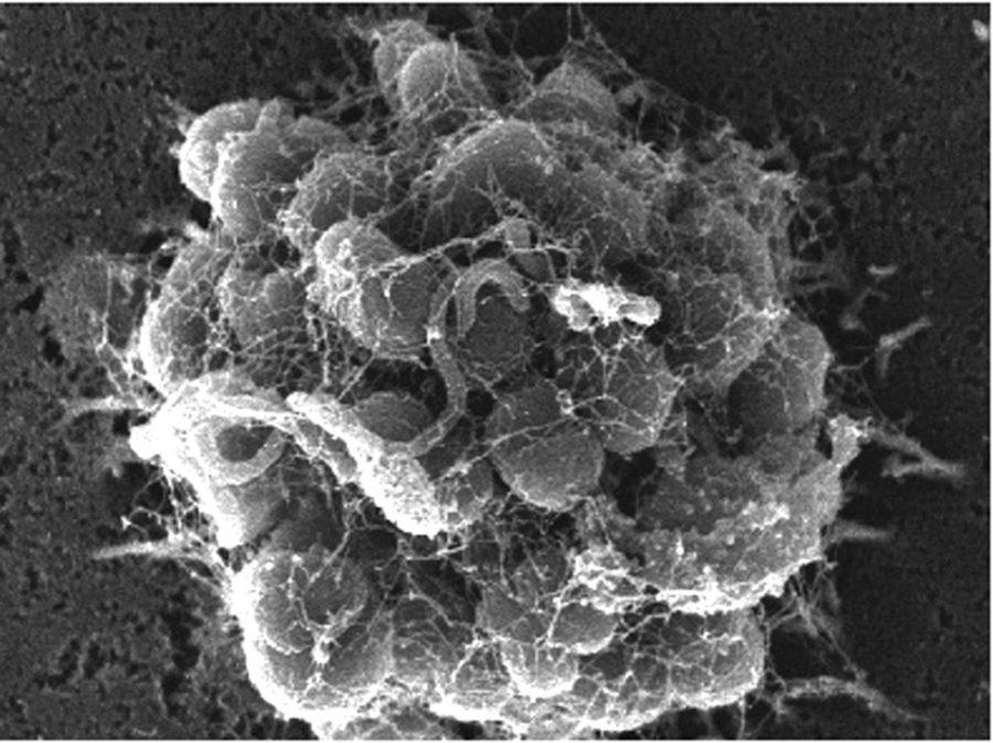 Courtesy of Maggie SoThis image of a cluster of Neisseria gonorrhoeae cells infecting a human epithelial cell was taken with a scanning electron microscope and appears in the journal Microbiology. The bacteria induces the host cell to produce noodle-like projections callled microvilli that wrap around the bacteria and interact with it.
