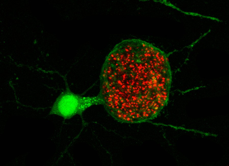 A cyst of toxoplasma parasites (red) inside a neuron (green). Although most people who carry toxoplasma do not display any symptoms, the parasite can be deadly in people with weakened immune systems.