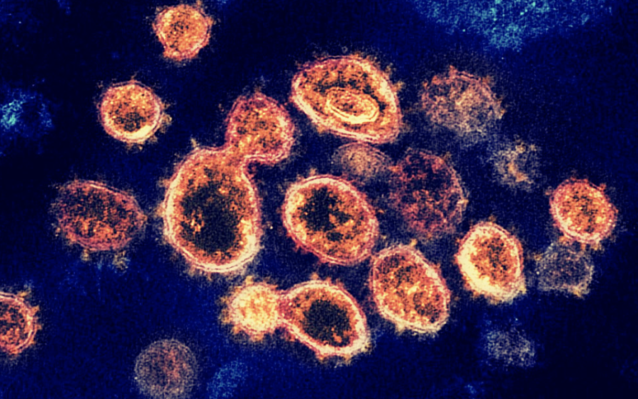 According to a study published in the Lancet, less than 10% of Americans have antibodies to the new coronavirus, suggesting that the U.S. is further from herd immunity than previously thought. Photo by quapan / Flickr (CC BY 2.0)