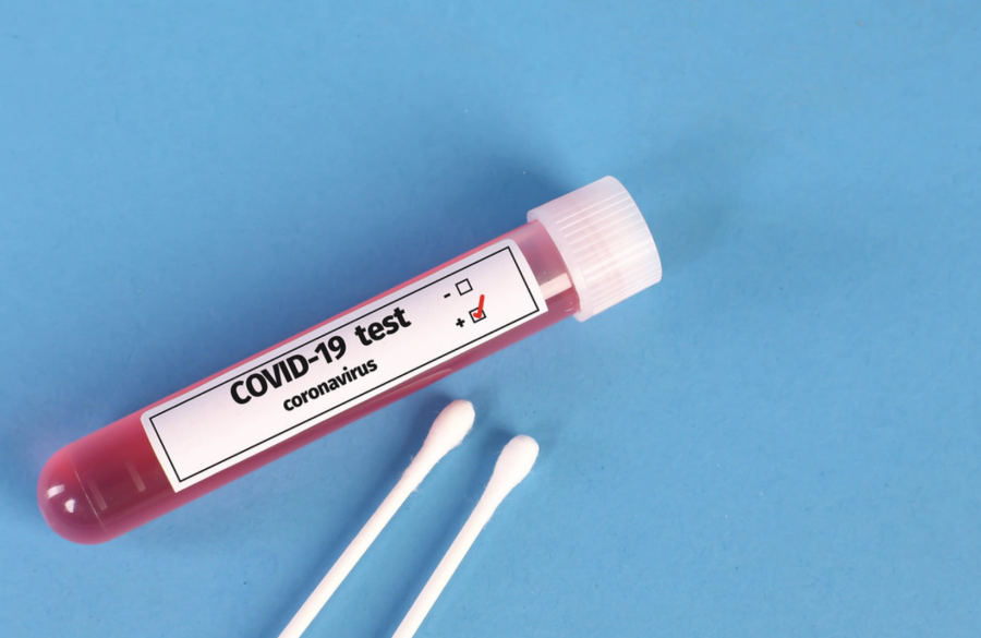 On+Nov.+17%2C+the+U.S.+FDA+authorized+the+first+at-home+coronavirus+test+from+Lucira+Health.+Recently%2C+the+U.S.+is+seeing+upwards+of+150%2C000+new+coronavirus+cases+per+day.+Tube+with+positive+blood+samples+for+Coronavirus+test+by+wuestenigel+is+licensed+with+CC+BY+2.0.%26nbsp%3B