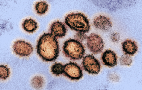 This week, the state altered the way it is distributing the vaccine to go to age-based categories, which means people with disabilities who are not living in group homes have to wait even longer to receive the vaccine. "Novel Coronavirus SARS-CoV-2" by NIAID is licensed with CC BY 2.0.