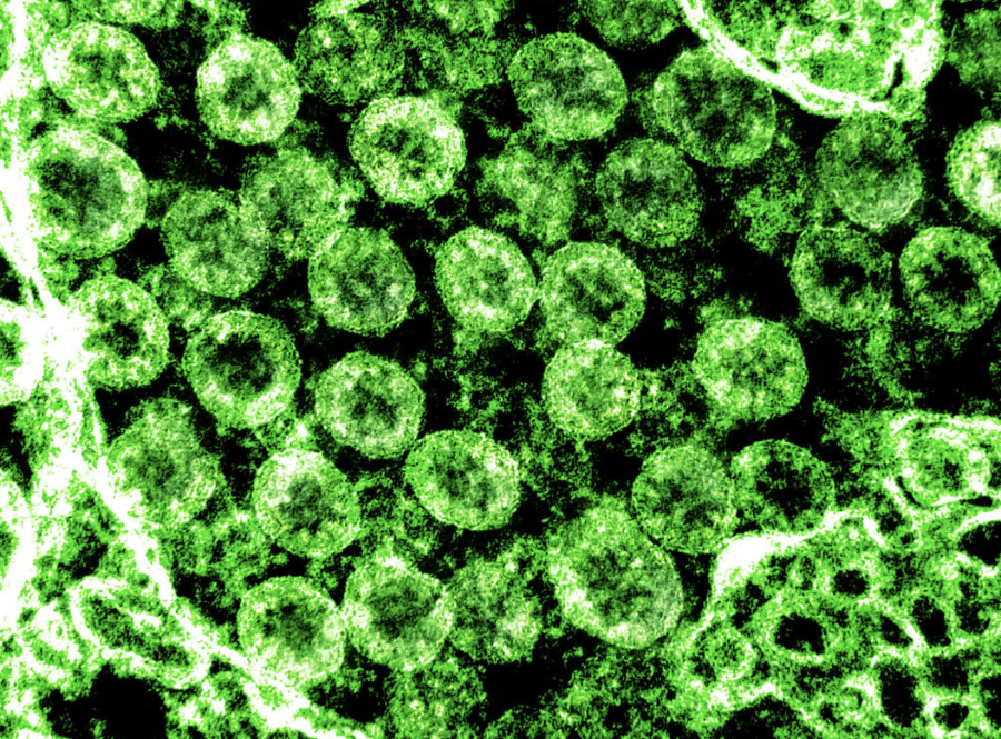 Researchers around the world are currently doing more research on the multiple coronavirus variants, with the goal of ending the global pandemic. Novel Coronavirus SARS-CoV-2 by NIAID is licensed with CC BY 2.0.