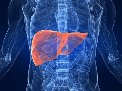 	Courtesy of humanillnesses.com / Cirrhosis, or scarring of the liver, can occur as a result of hepatitis or prolonged alcohol abuse. A recent discovery by UA researchers could lead to new treatments for end-stage liver disease.