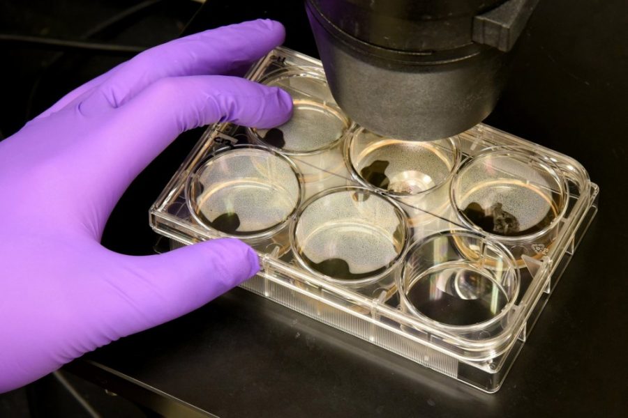 Technician Ce Zhang gets ready to examine a six-well plate containing pluripotent stem cell colonies under a microscope at the Johns Hopkins Institute for Cell Engineering in Baltimore, Maryland on Tuesday, March 1. The Zika virus has been making headlines again this week, this time in Maricopa County.