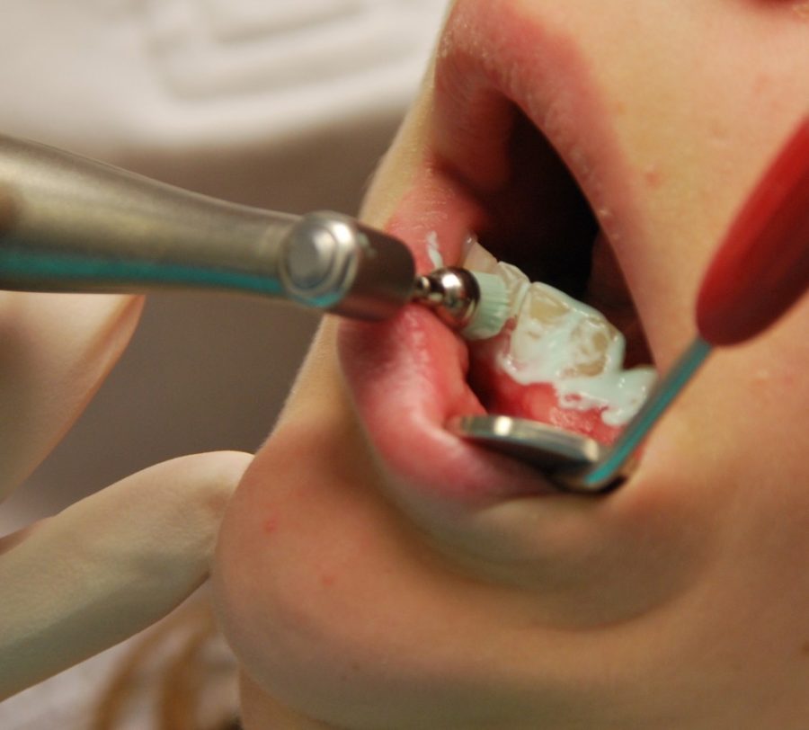 Dental+care+can+often+be+outside+of+students+budgets%2C+yet+it+has+a+large+role+in+their+wellbeing.+The+UA+should+include+dental+care+in+its+insurance+plans.