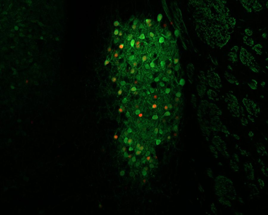 Neurons within the BNST (green) that activate due to an inflammatory signal (red). These neurons suppress feeding when active.