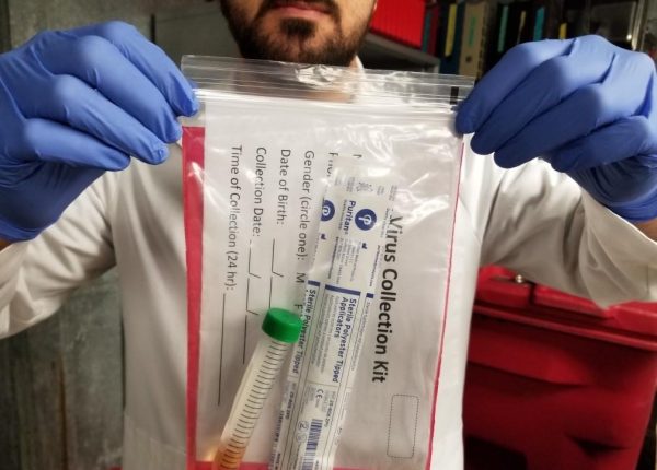 A researcher at the University of Arizona holds a serology test used for detecting the presence of antibodies against the virus that causes COVID-19. If you believe you have symptoms, the UA offers many testing sites around campus. Courtesy Gerri Kelly.