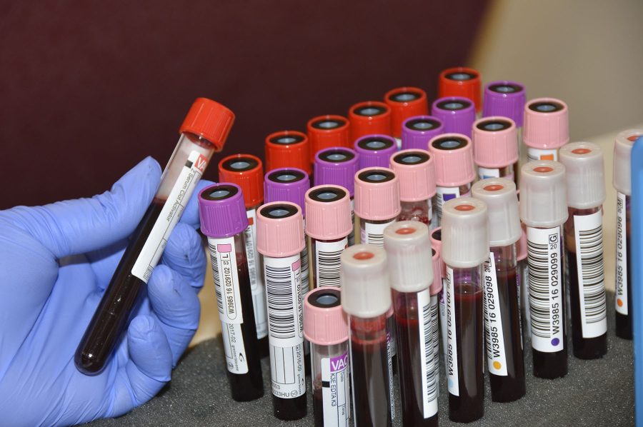 Vials of blood donated by Airmen from the 145th Airlift Wing wait to be tested by Community Blood Center of the Carolinas. Over a dozen tests are performed on each vial including establishing blood types. The blood collected during the blood drive held on April 9, 2016 at the North Carolina Air National Guard Base, Charlotte Douglas International Airport, helps patients within the local community. Donating one pint takes an hour or less, and in the end one walks away having saved up to three lives. Courtesy U.S. Air National Guard, photo by Master Sgt. Patricia F. Moran.